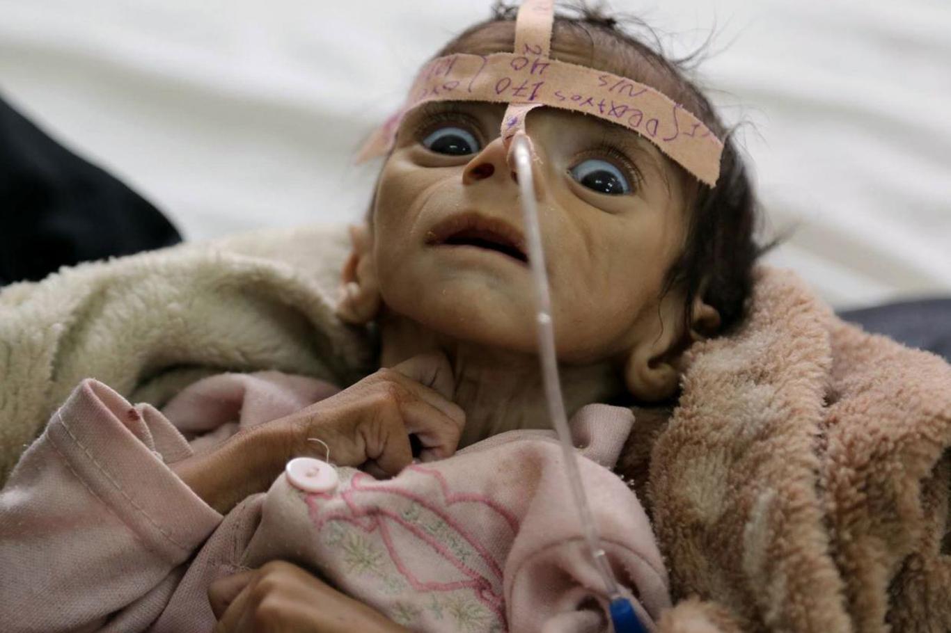 Yemen halkı kıtlıkla karşı karşıya Yemen halkı kıtlıkla karşı karşıya